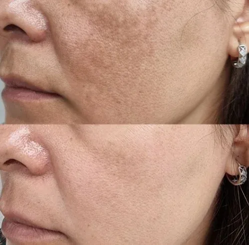 Resultado real de cliente