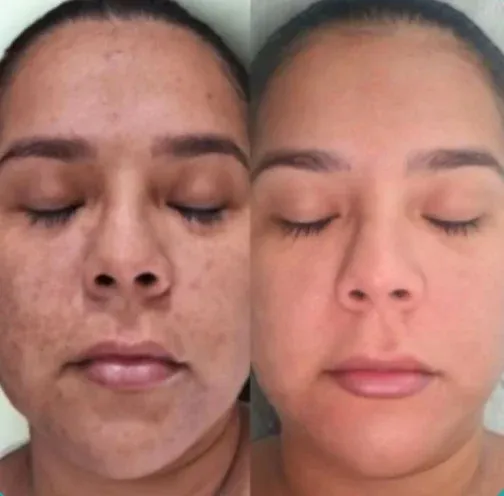 Resultado real de cliente