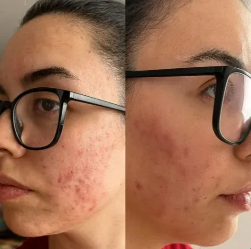 Resultado real de cliente